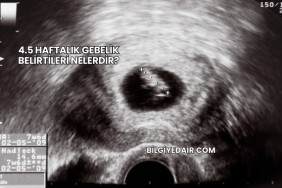 4.5 Haftalık Gebelik Belirtileri Nelerdir?