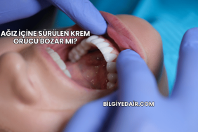 Ağız İçine Sürülen Krem Orucu Bozar mı?