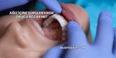 Ağız İçine Sürülen Krem Orucu Bozar mı?