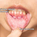 Ağızdaki Yara Orucu Bozar mı?