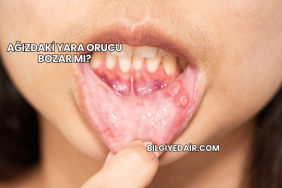 Ağızdaki Yara Orucu Bozar mı?