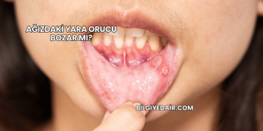 Ağızdaki Yara Orucu Bozar mı?