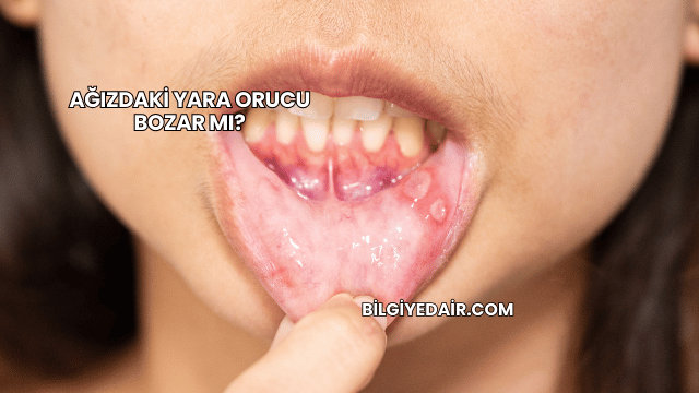Ağızdaki Yara Orucu Bozar mı?