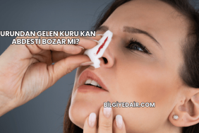 Burundan Gelen Kuru Kan Abdesti Bozar mı?