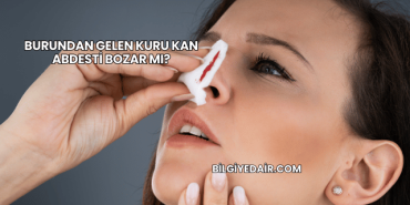 Burundan Gelen Kuru Kan Abdesti Bozar mı?