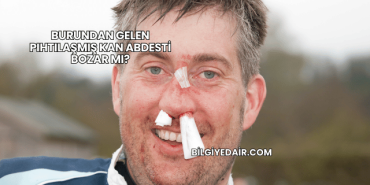 Burundan Gelen Pıhtılaşmış Kan Abdesti Bozar mı?