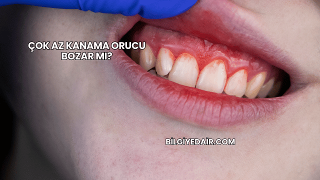 Çok Az Kanama Orucu Bozar mı?