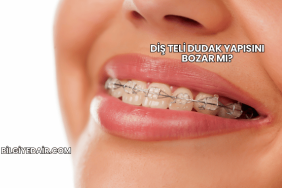 Diş Teli Dudak Yapısını Bozar mı?