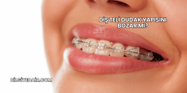 Diş Teli Dudak Yapısını Bozar mı?