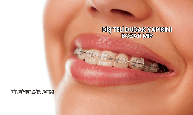 Diş Teli Dudak Yapısını Bozar mı?
