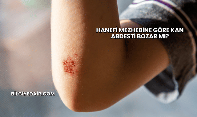 Hanefi Mezhebine Göre Kan Abdesti Bozar mı?