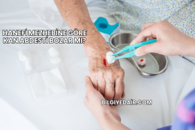 Hanefi Mezhebine Göre Kan Abdesti Bozar mı?