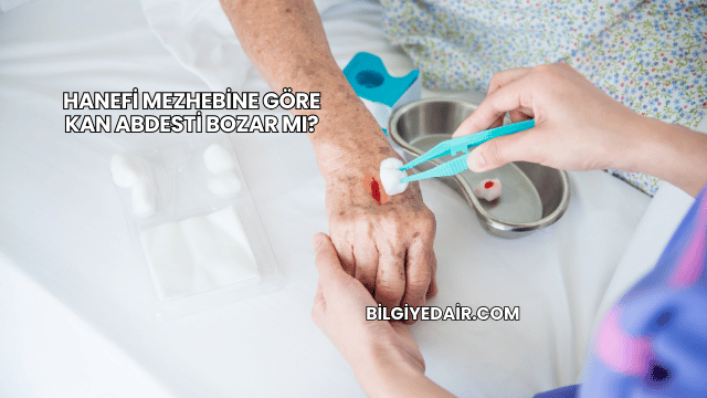 Hanefi Mezhebine Göre Kan Abdesti Bozar mı?