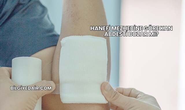 Hanefi Mezhebine Göre Kan Abdesti Bozar mı?