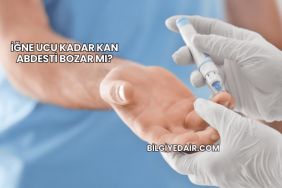 İğne Ucu Kadar Kan Abdesti Bozar mı?