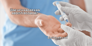 İğne Ucu Kadar Kan Abdesti Bozar mı?
