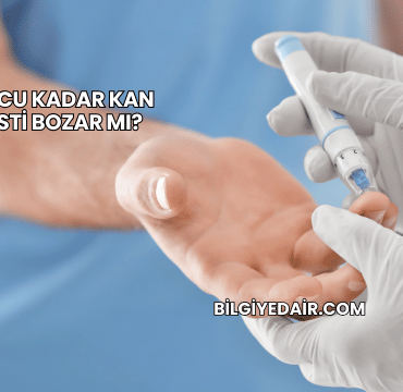 İğne Ucu Kadar Kan Abdesti Bozar mı?