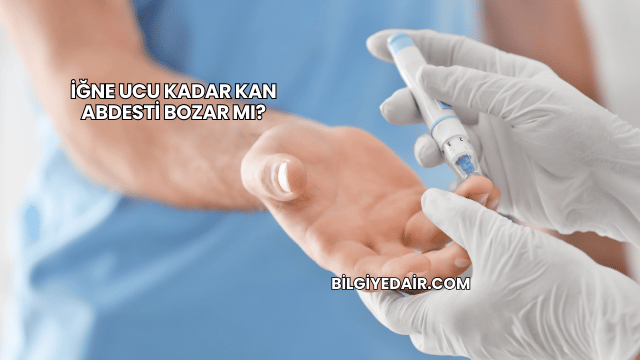 İğne Ucu Kadar Kan Abdesti Bozar mı?