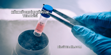 Kök Hücre ile Körlük Tedavisi