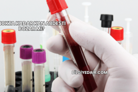 Nokta Kadar Kan Abdesti Bozar mı?