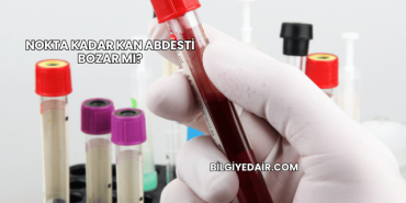 Nokta Kadar Kan Abdesti Bozar mı?