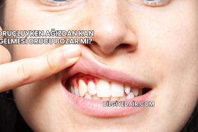 Oruçluyken Ağızdan Kan Gelmesi Orucu Bozar mı?