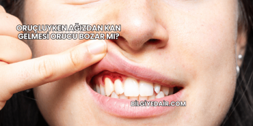 Oruçluyken Ağızdan Kan Gelmesi Orucu Bozar mı?