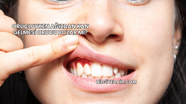 Oruçluyken Ağızdan Kan Gelmesi Orucu Bozar mı?