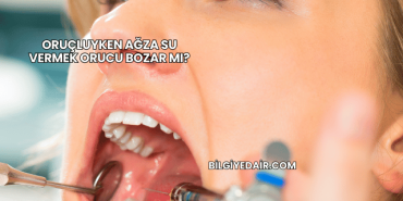 Oruçluyken Ağza Su Vermek Orucu Bozar mı?