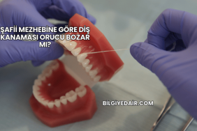 Şafii Mezhebine Göre Diş Kanaması Orucu Bozar mı?