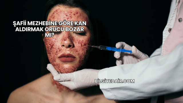 Şafii Mezhebine Göre Kan Aldırmak Orucu Bozar mı?