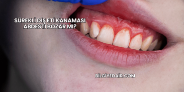 Sürekli Diş Eti Kanaması Abdesti Bozar mı?