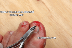 Tırnak Kanaması Abdesti Bozar mı?