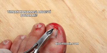 Tırnak Kanaması Abdesti Bozar mı?