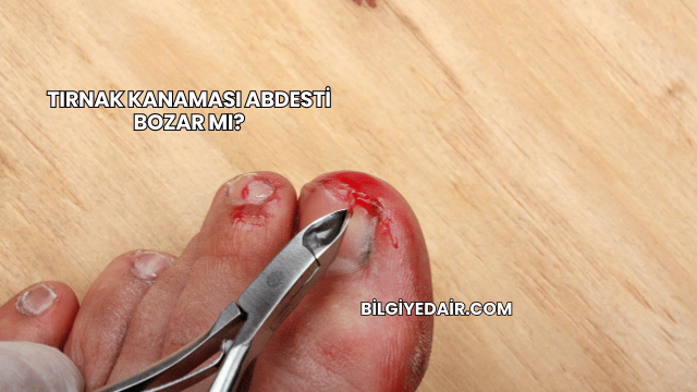 Tırnak Kanaması Abdesti Bozar mı?