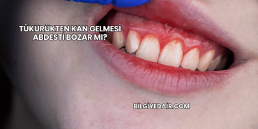 Tükürükten Kan Gelmesi Abdesti Bozar mı?