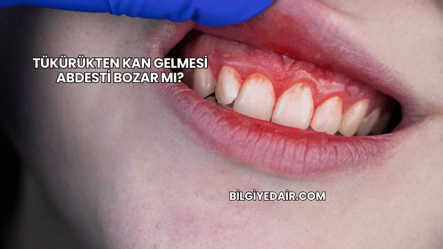 Tükürükten Kan Gelmesi Abdesti Bozar mı?