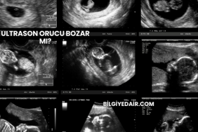 Ultrason Orucu Bozar mı?