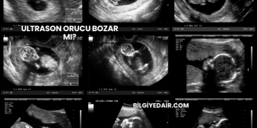 Ultrason Orucu Bozar mı?