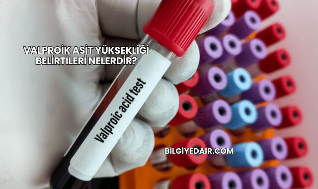 Valproik Asit Yüksekliği Belirtileri Nelerdir?