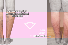 Vertebrobaziler Yetmezlik Belirtileri Nelerdir?