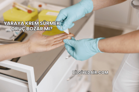 Yaraya Krem Sürmek Oruç Bozar mı?