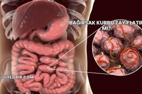 Bağırsak Kurdu Zayıflatır mı?
