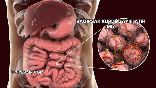 Bağırsak Kurdu Zayıflatır mı?