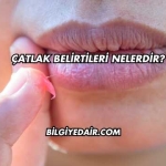 Çatlak Belirtileri Nelerdir?