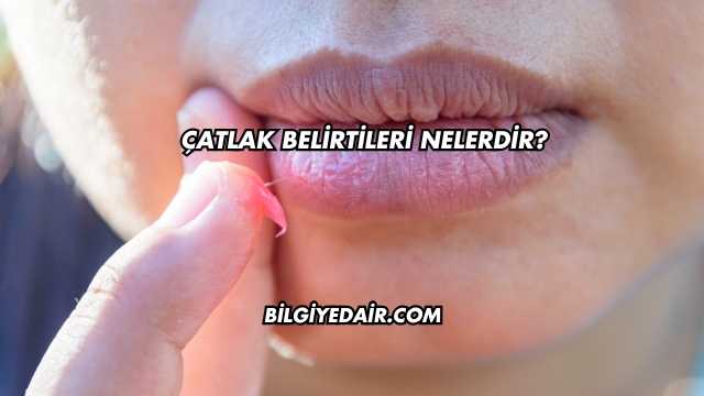 Çatlak Belirtileri Nelerdir?