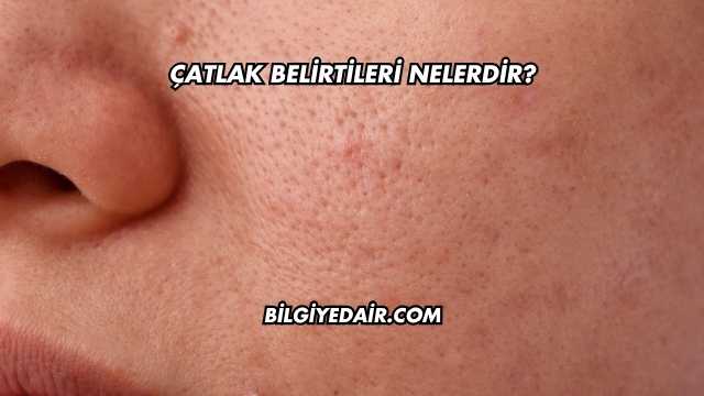 Çatlak Belirtileri Nelerdir?