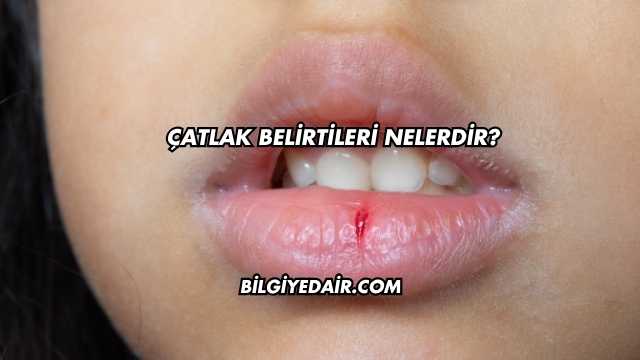 Çatlak Belirtileri Nelerdir?