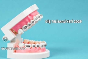 Diş Teli Maliyeti 2025
