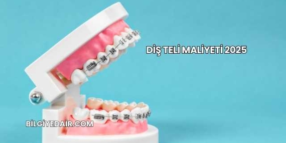 Diş Teli Maliyeti 2025